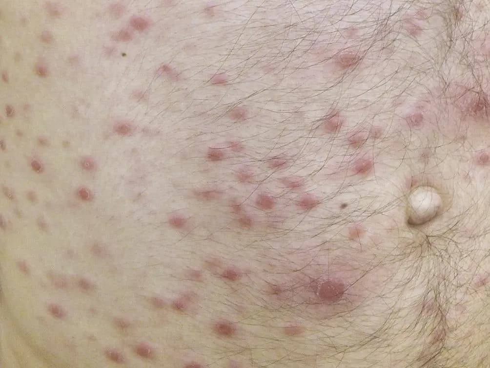 Blady jak ściana: co oznacza i jakie są jego przyczyny?